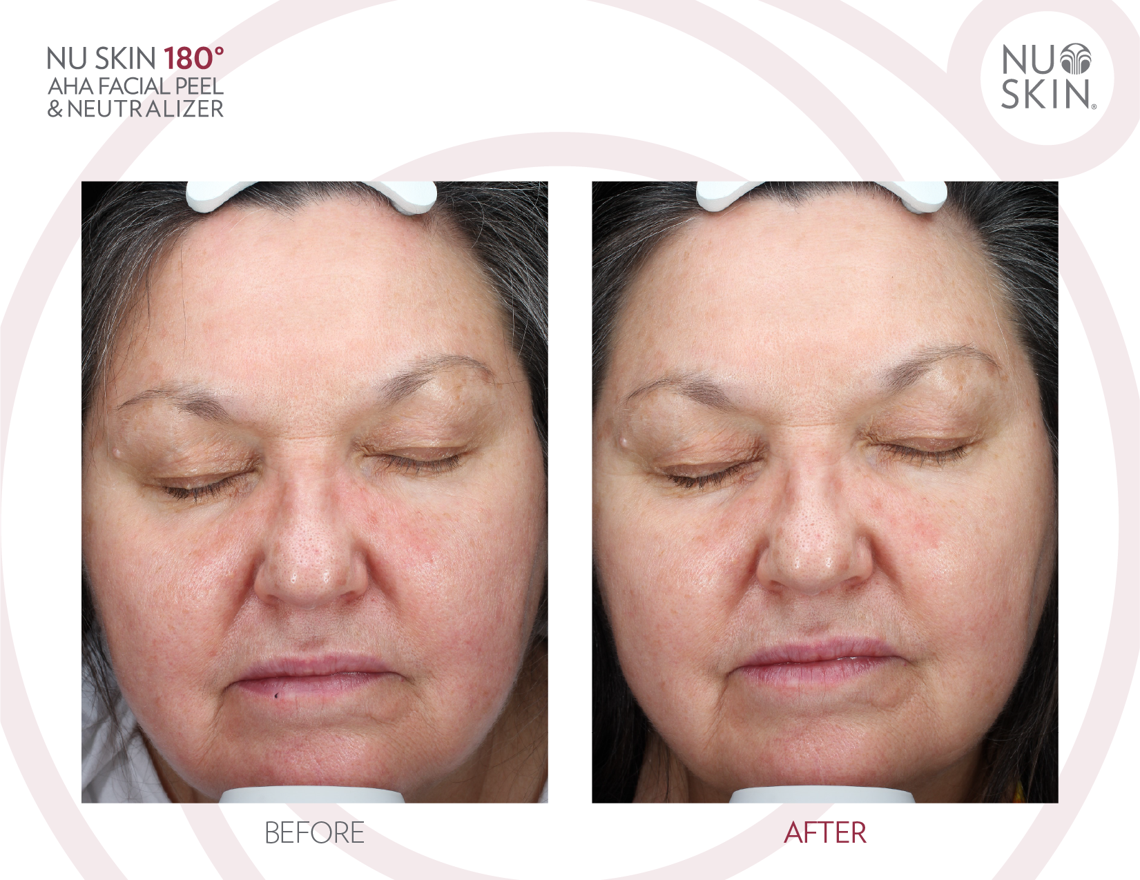 180°® AHA Facial Peel and Neutralizer