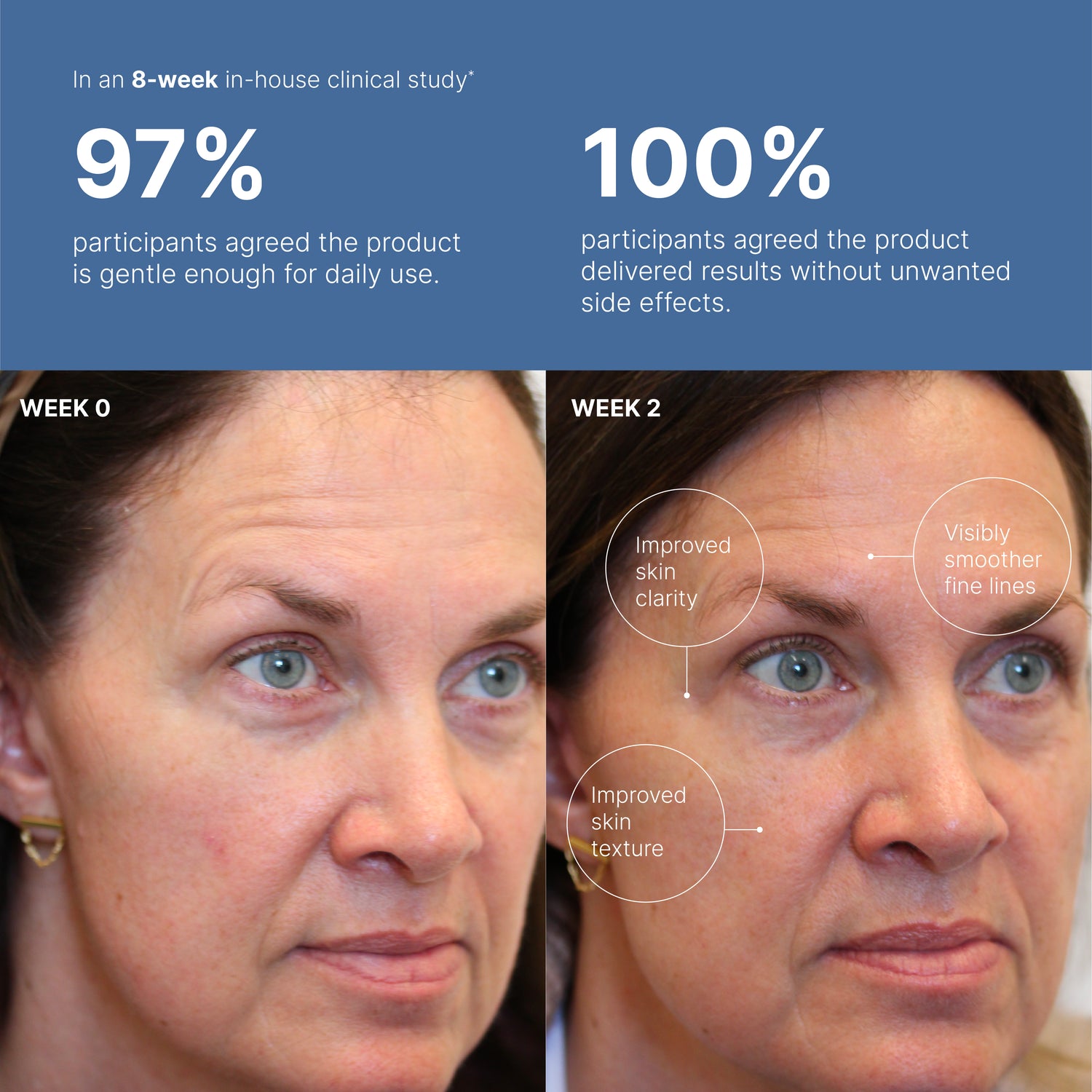 ageLOC® Tru Face® Peptide Retinol Complex