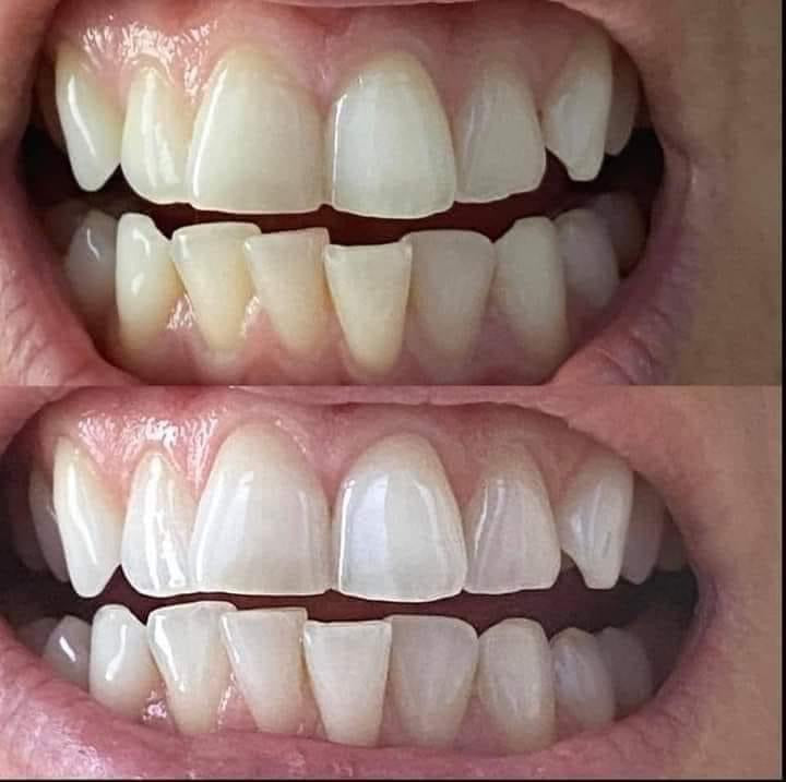 AP 24® Whitening Fluoride-Free Toothpaste