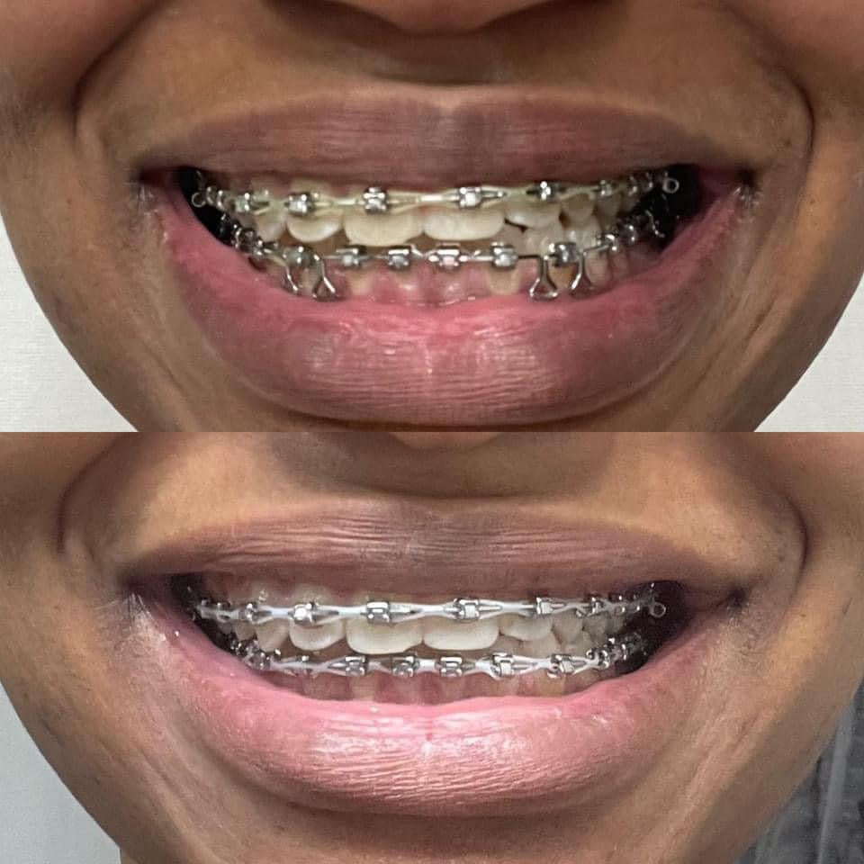 AP 24® Whitening Fluoride-Free Toothpaste