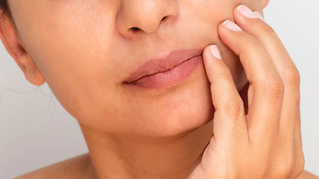 Dry Skin