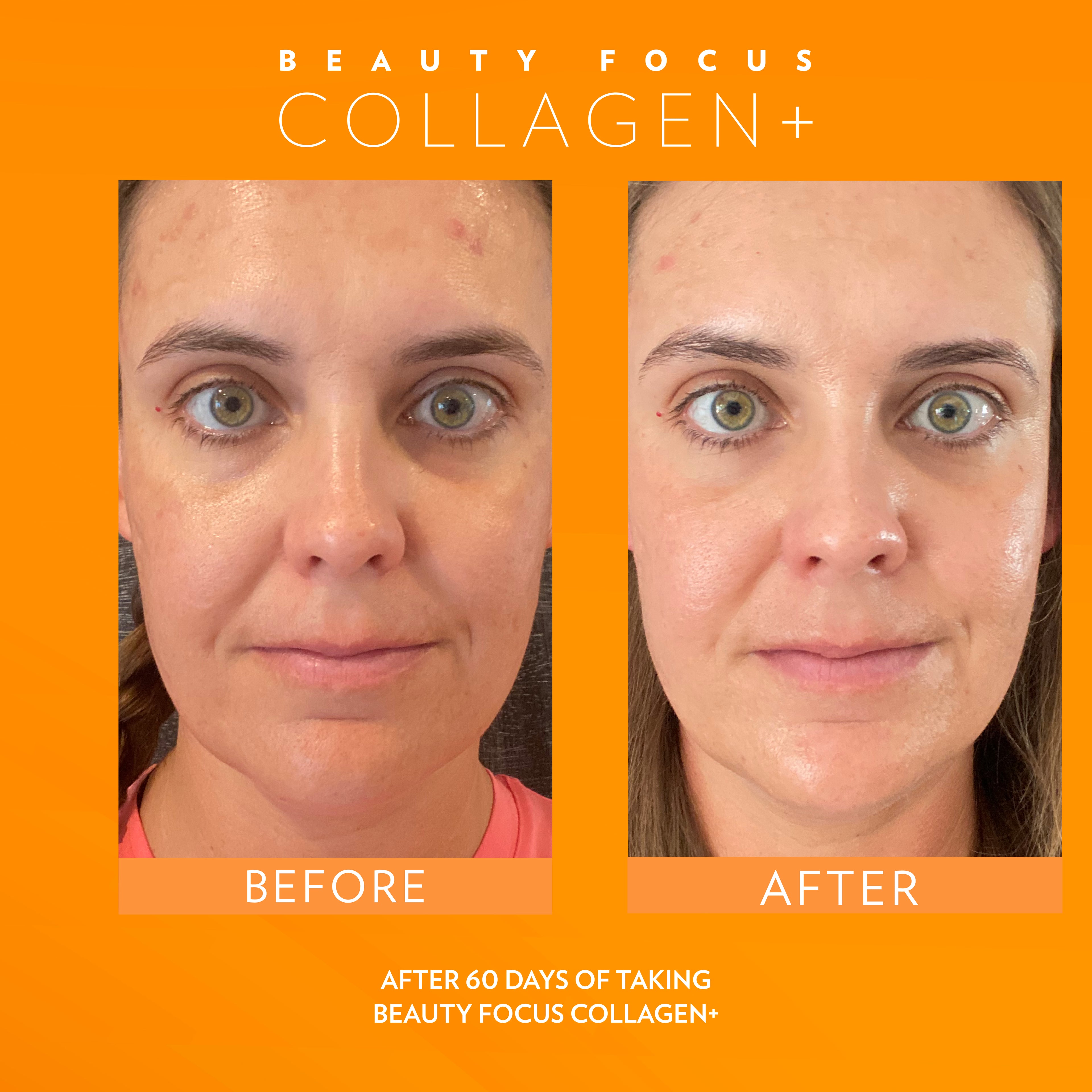 Beauty Focus® Collagen+ Peach