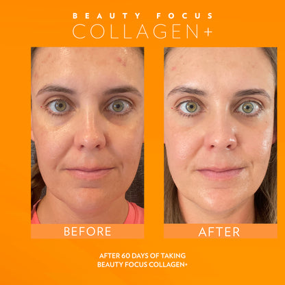 Beauty Focus® Collagen+ Peach